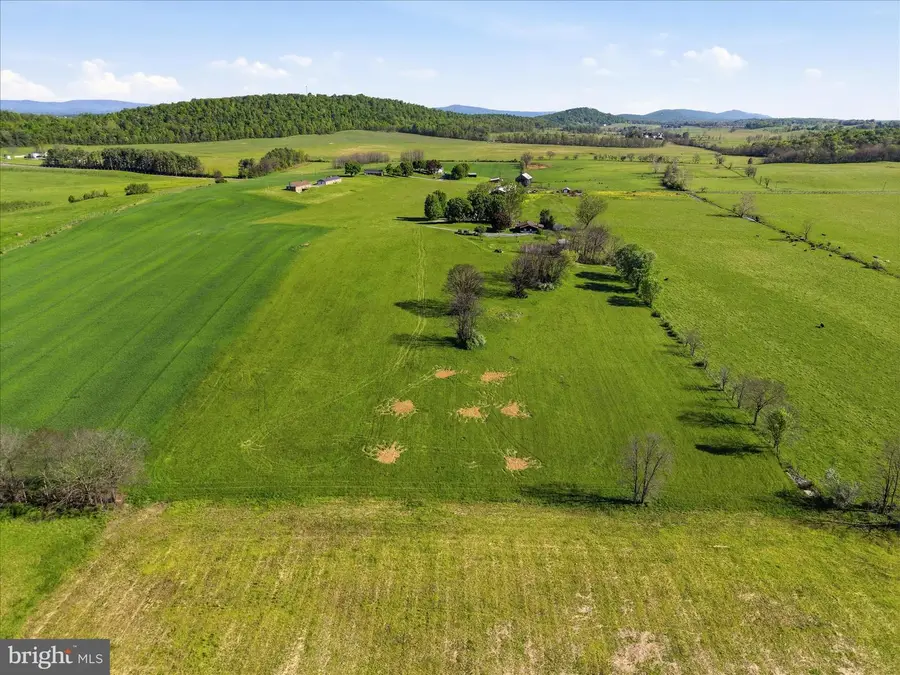 Tbd Golds Hill Rd, Winchester, VA 22603 - #3