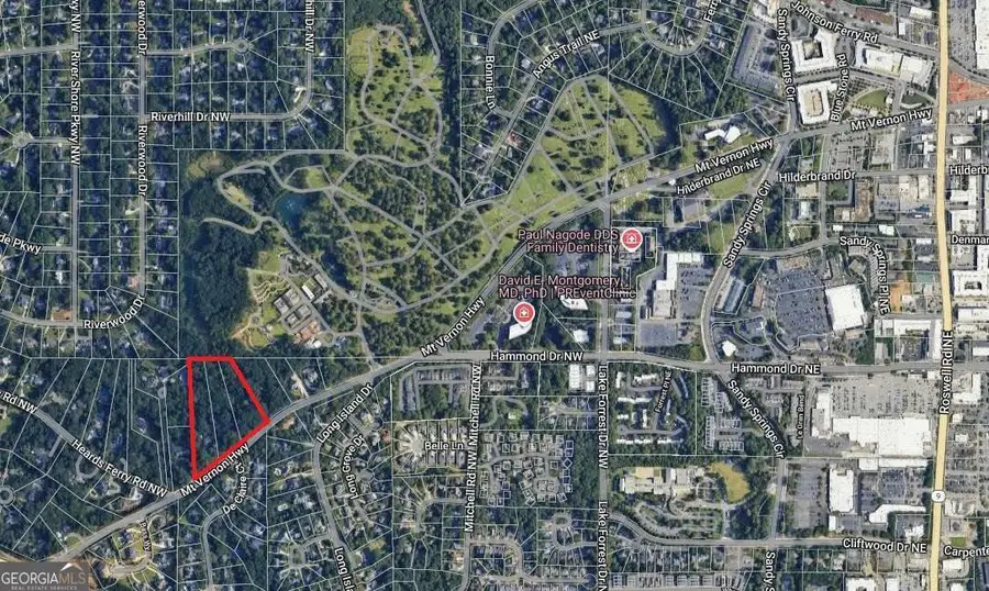 261 Mount Vernon Highway Nw, Atlanta, GA 30328 - #3