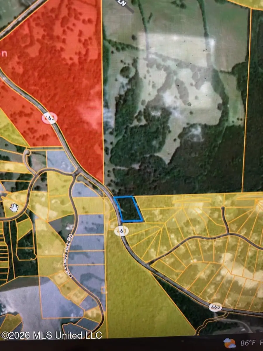 0 Highway 463, Madison, MS 39110 - #2