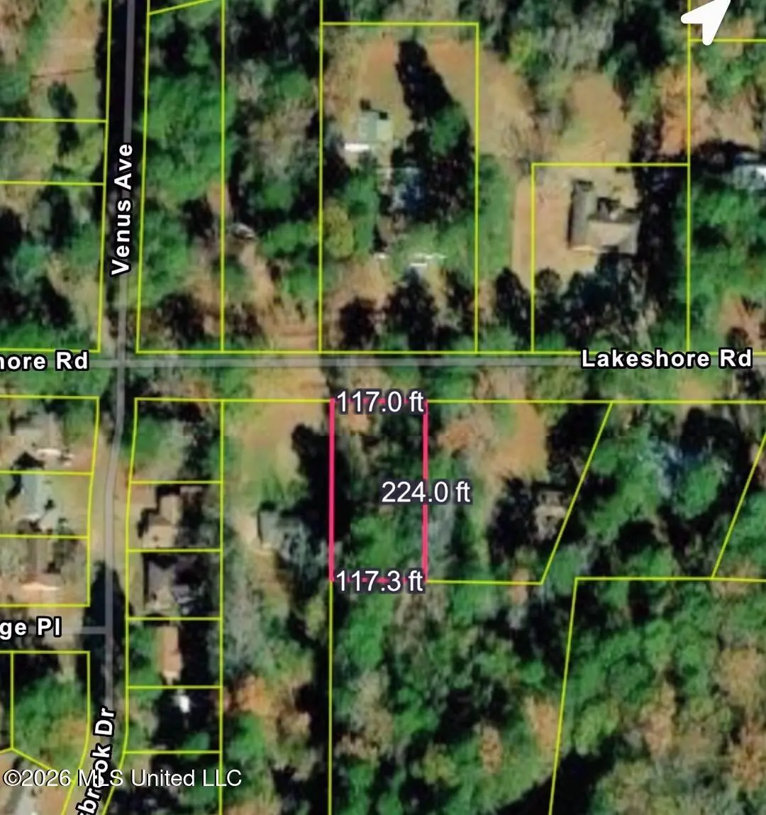 Lake Shore Road, Jackson, MS 39212 - #1